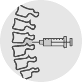 Lumbar Epidural